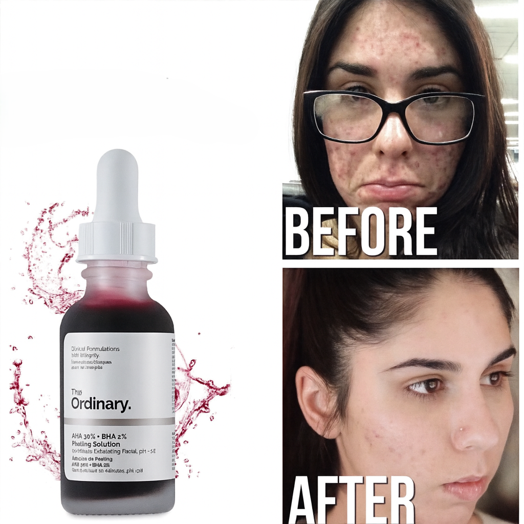 ACIDO GLICOLICO + PEELING COMBO
