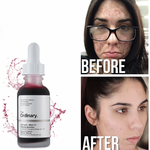 ACIDO GLICOLICO + PEELING COMBO