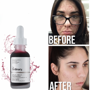ACIDO GLICOLICO + PEELING COMBO